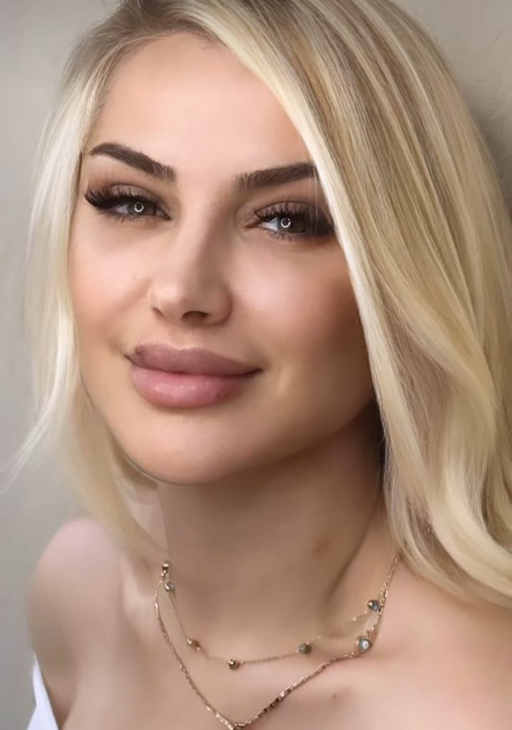 Songül Karlı Estetik
